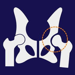 Hip Dysplasia in Dogs: Diagnosis, Causes, & Treatments